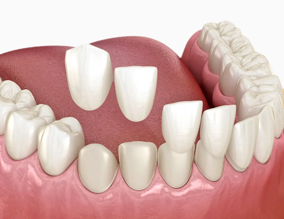 Konzervativna stomatologija